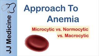 Anemia  Microcytic vs Normocytic vs Macrocytic [upl. by Laup]