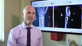 Broken Wrists Fracture Types Treatment Options amp Recovery  Dr Froelich [upl. by Brunhilda519]