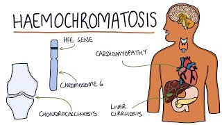 Understanding Haemochromatosis [upl. by Idaf408]