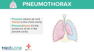 Pneumothorax Definition Types and classification Preview [upl. by Josh]