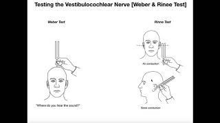 Interpreting the WeberRinne Tests EXPLAINED [upl. by Royce]