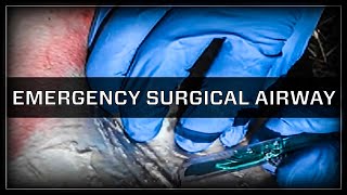 Emergency Surgical Airway  Cricothyroidotomy [upl. by Aramat]