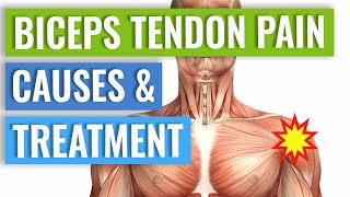 Biceps Tendonitis Treatment and Exercises Explained [upl. by Athalia]