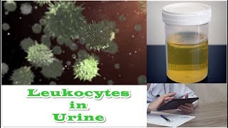 Leukocytes in Urine  No Nitrates [upl. by Nallid]