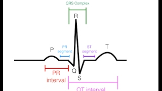 EKGECG Interpretation Basic  Easy and Simple [upl. by Eirrehc]