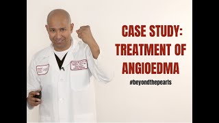 Treatment of Angioedema Case [upl. by Pauly]