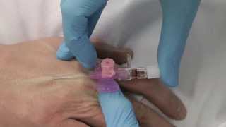 Cannulation How to gain IV access [upl. by Innep]