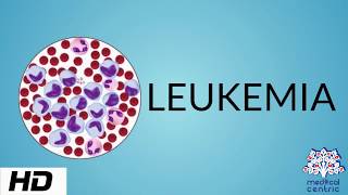 LEUKEMIA Causes Signs and Symptoms Diagnosis and Treatment [upl. by Aeret584]