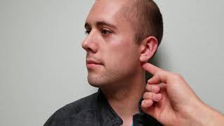 Chvosteks Sign of Hypocalcemia Facial Nerve Tapping [upl. by Maxma]