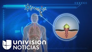 Cómo atacan los opiáceos sintéticos al cuerpo humano y cómo llegan estos a EEUU [upl. by Lleznov881]