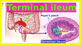 terminal ileum [upl. by Anawat]