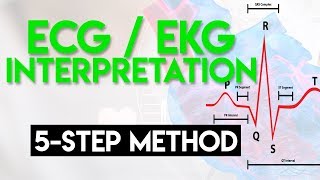 ECG Interpretation Made Easy  ECG EKG Interpretation Part 2 [upl. by Anerat301]