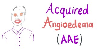 Acquired Angioedema AAE [upl. by Sonaj266]