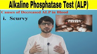 Alkaline Phosphatase Test ALP [upl. by Nwahsek]