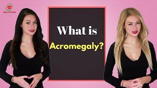 What is Acromegaly  Causes Pictures Signs and Symptoms of Acromegaly [upl. by Minabe]