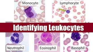 Identifying Leukocytes [upl. by Ilamad709]