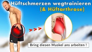 Hüftschmerzen sind KEINE Hüftarthrose  Ursache amp Lösung durch Übungen [upl. by Deyas]