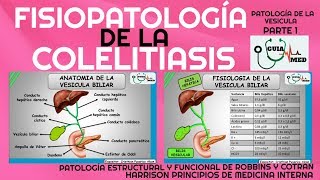 COLELITIASIS FISIOPATOLOGÍA GuiaMed [upl. by Allison]