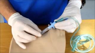 Needle Cricothyroidotomy [upl. by Ahtikal407]