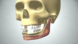 Revolution in Bone Regeneration [upl. by Lagiba]