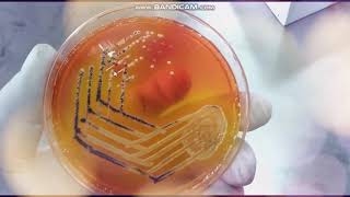 Xylose Lysine Deoxycholate agar  XLD  Selective medium for Salmonella and Shigella [upl. by Benedetta632]