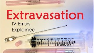 Extravasation  IV Infiltration Errors Explained Doctor Interview [upl. by Iarahs]