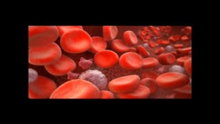 Anemia Lesson 4  Clues from the blood smear [upl. by Ihpen]