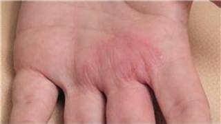 Dermatology Treatments  How to Diagnose Skin Rashes [upl. by Jonathon]