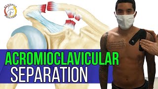 AC Joint Provocation Cluster  Acromioclavicular Joint Pathology [upl. by Wagstaff843]