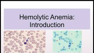 Hemolytic Anemias Introduction and Classification [upl. by Lengel]