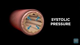 Low Diastolic Blood Pressure Symptoms [upl. by Nospmas]