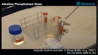 Alkaline Phosphatase Stain [upl. by Rozamond]