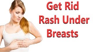 8 Remedies To Get Rid Of A Rash Under Breasts [upl. by Sweyn]