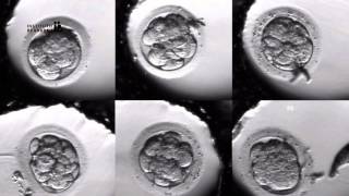 IVF PROCESS STEP BY STEP In Vitro Fertilisation Embryo cultivation [upl. by Cornew581]