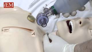 Simple Needle Cricothyroidotomy Options [upl. by Aramot27]