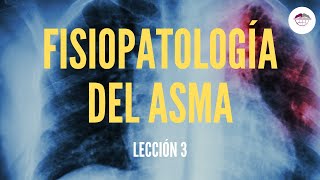 3 FISIOPATOLOGÍA DEL ASMA FISIOPATOLOGÍA RESPIRATORIA [upl. by Neelyaj764]