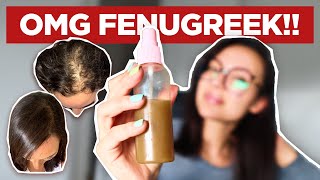 THE RIGHT WAY TO USE FENUGREEK FOR HAIR GROWTH AND HAIR LOSS I was blown away by the results [upl. by Nnahgiel]