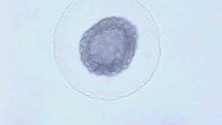 Amphioxus embryonic development [upl. by Anivol]